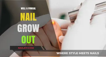 Fungal Nail Infections: Can You Outgrow Them?