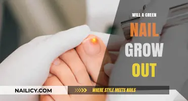 Green Nails: Will They Grow Out?