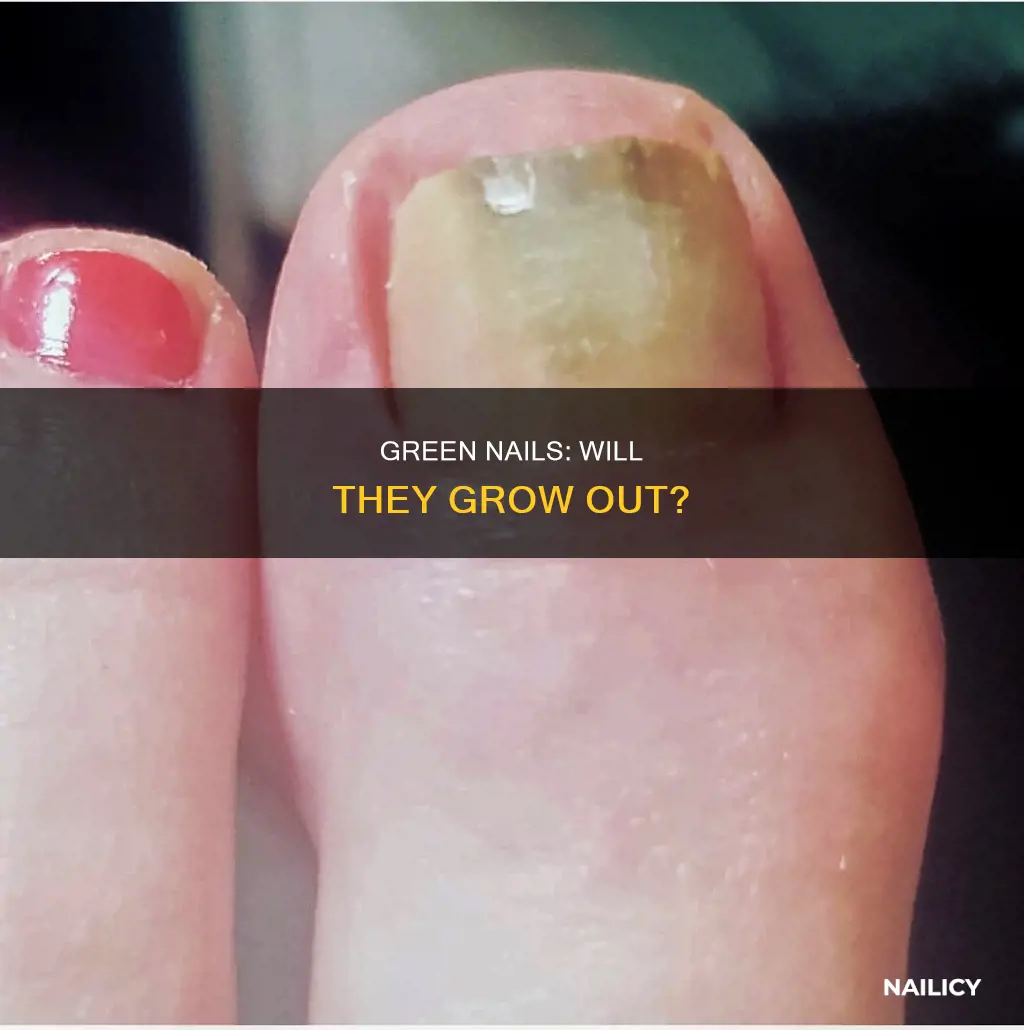 will a green nail grow out