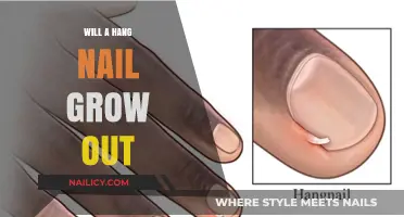 Hangnail Woes: Can They Grow Out?
