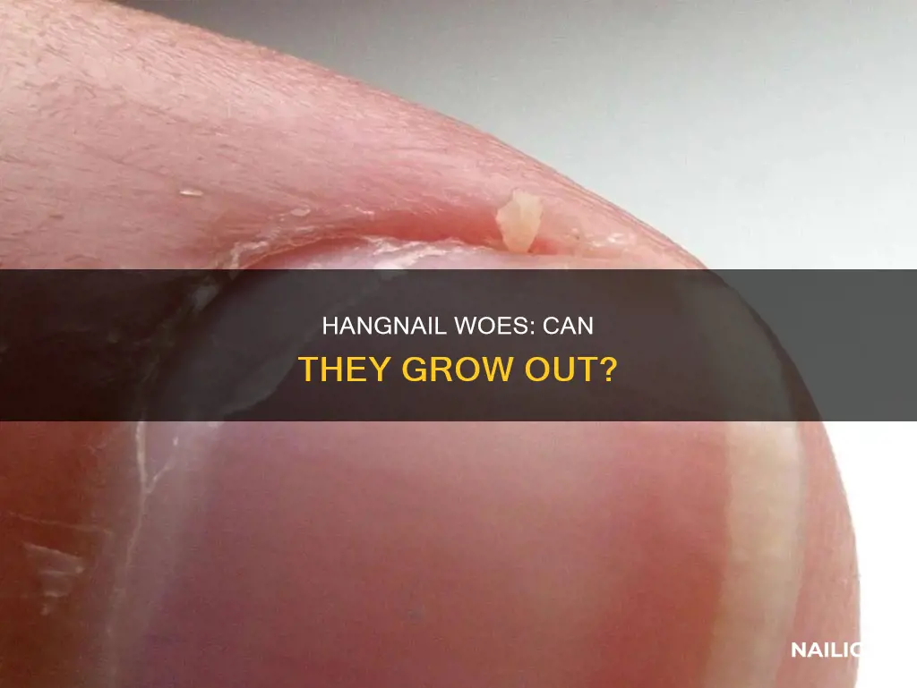 will a hang nail grow out