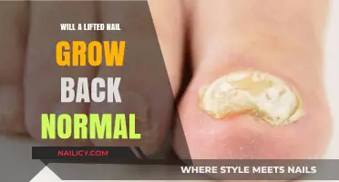 How to Treat and Grow Back a Lifted Nail