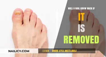 Can Nails Regrow After Being Removed?