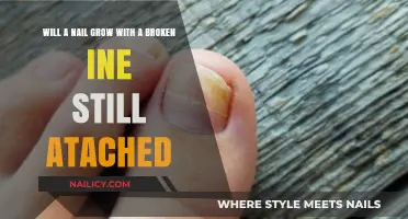 How Nails Grow with a Broken Tip Attached
