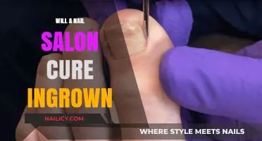 Can a Nail Salon Fix Ingrown Toenails? What You Need to Know