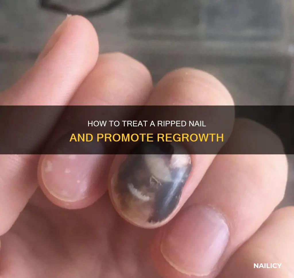will a ripped nail grow back