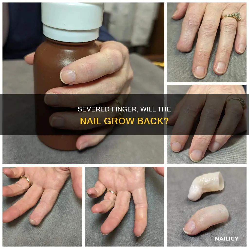 will a severed finger grow a nail