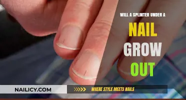 Splinter Under Nail: Can You Let It Grow Out?