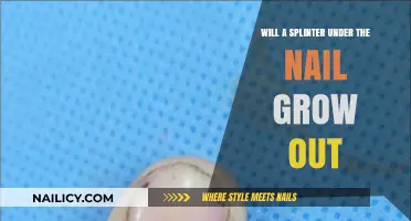 Splinter Under Nail: Can You Grow It Out?