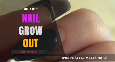 How to Treat and Grow Out a Split Nail