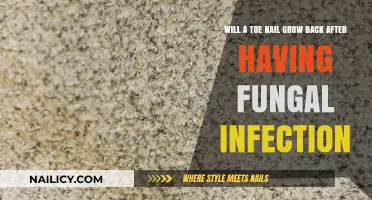 Toe Nail Recovery: Fungal Infections