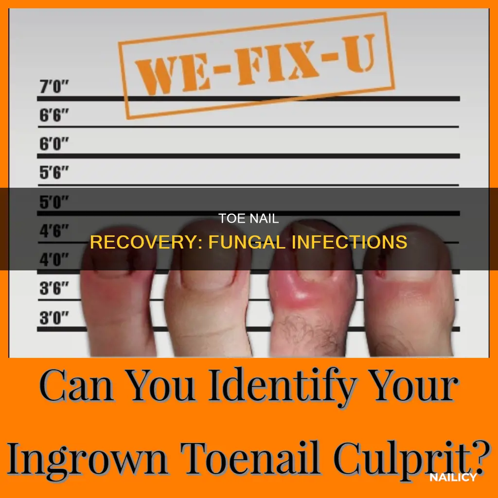 will a toe nail grow back after having fungal infection