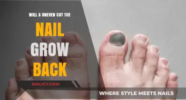 Unevenly Cut Toenails: Will They Grow Back?
