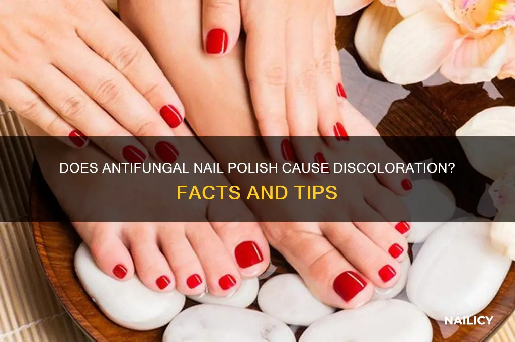 will antifungal nail polish discolor my nails