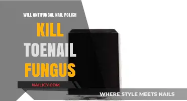 Can Antifungal Nail Polish Effectively Eliminate Toenail Fungus?