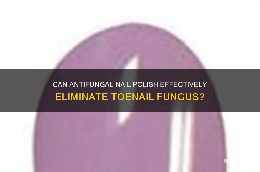 will antifungal nail polish kill toenail fungus