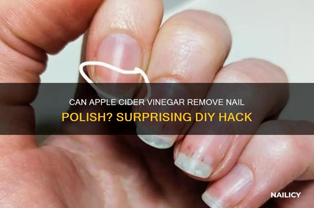 will apple cider vinegar take off nail polish