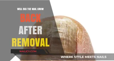 Big Toe Nail Removal: Will It Grow Back?