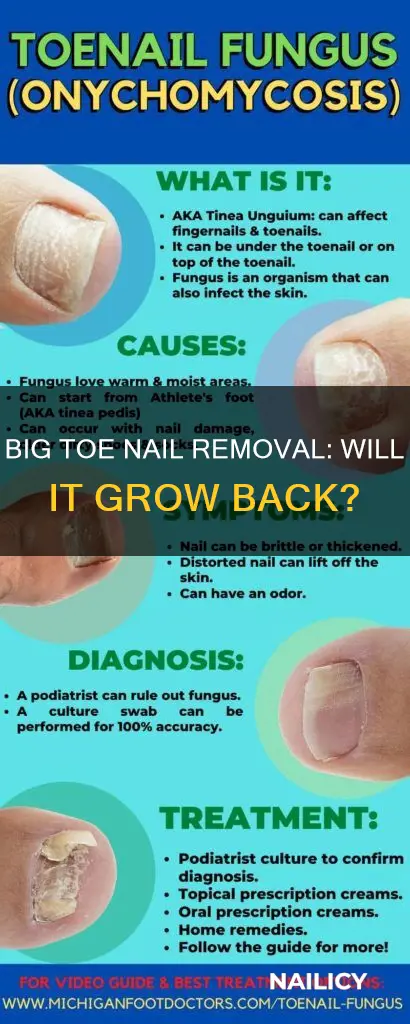 will big toe nail grow back after removal
