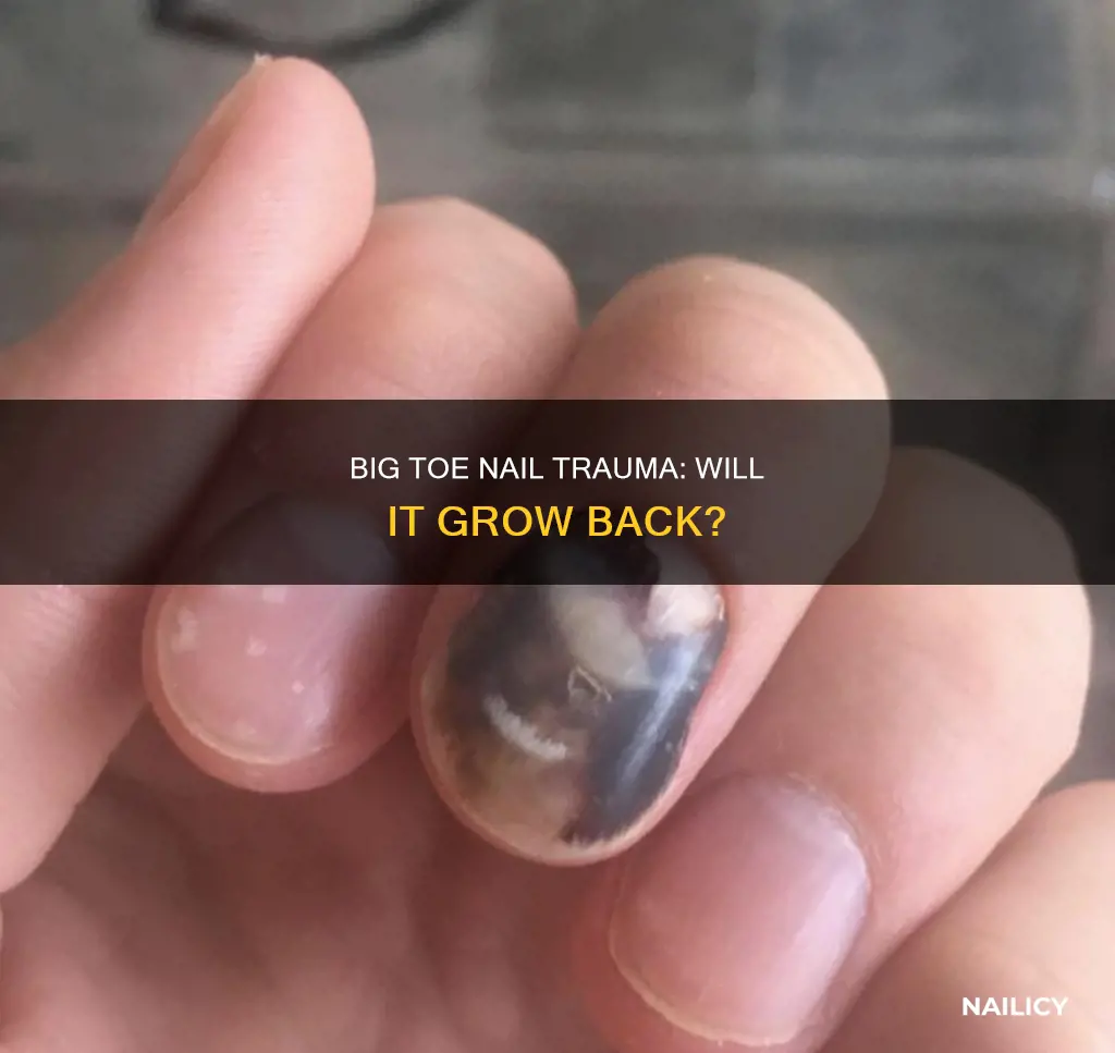 will big toe nail grow back
