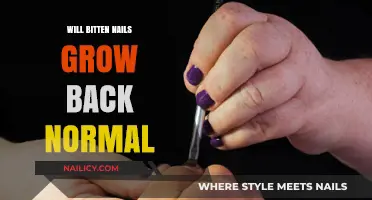 Bitten Nails: Can They Regrow Normally?