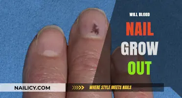 How Long Does It Take for a Blood Nail to Grow Out?