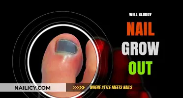 How Long Until Your Bloody Nail Grows Out?