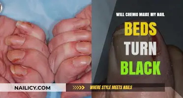 Chemotherapy and Nail Discoloration: Understanding Black Nail Beds