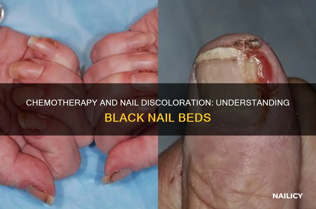 will chemo make my nail beds turn black