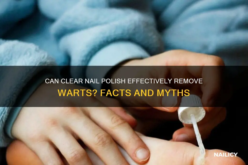 will clear nail polish kill a wart