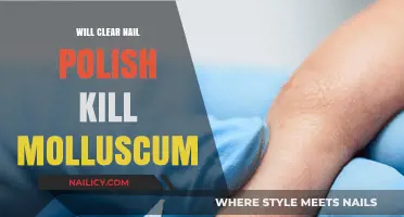 Clear Nail Polish and Molluscum: Effective Treatment or Myth?