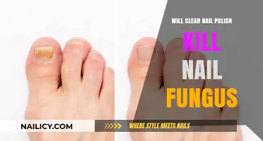 Can Clear Nail Polish Effectively Treat or Kill Nail Fungus?