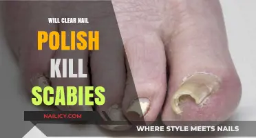 Can Clear Nail Polish Effectively Kill Scabies? Facts and Myths