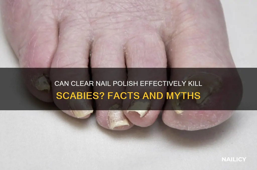 will clear nail polish kill scabies