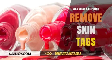 Clear Nail Polish: An Effective Skin Tag Remover?