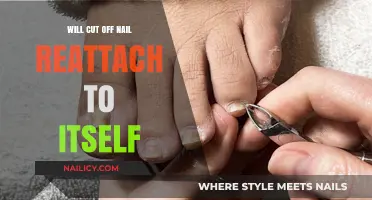 How to Reattach a Fingernail After it's Been Cut Off