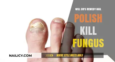 Can Dr.'s Remedy Nail Polish Effectively Treat Fungal Infections?