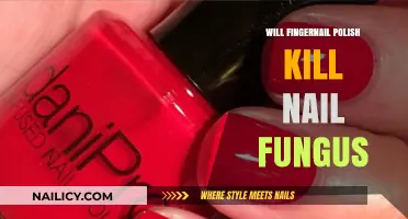 Can Nail Polish Effectively Treat or Kill Toenail Fungus?