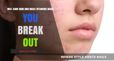 Can Hair, Skin, and Nails Vitamins Trigger Breakouts? Find Out