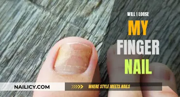 Will I Lose My Finger Nail? Understanding the Causes and Prevention