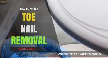 Toe Nail Removal: Is It Covered by INC?