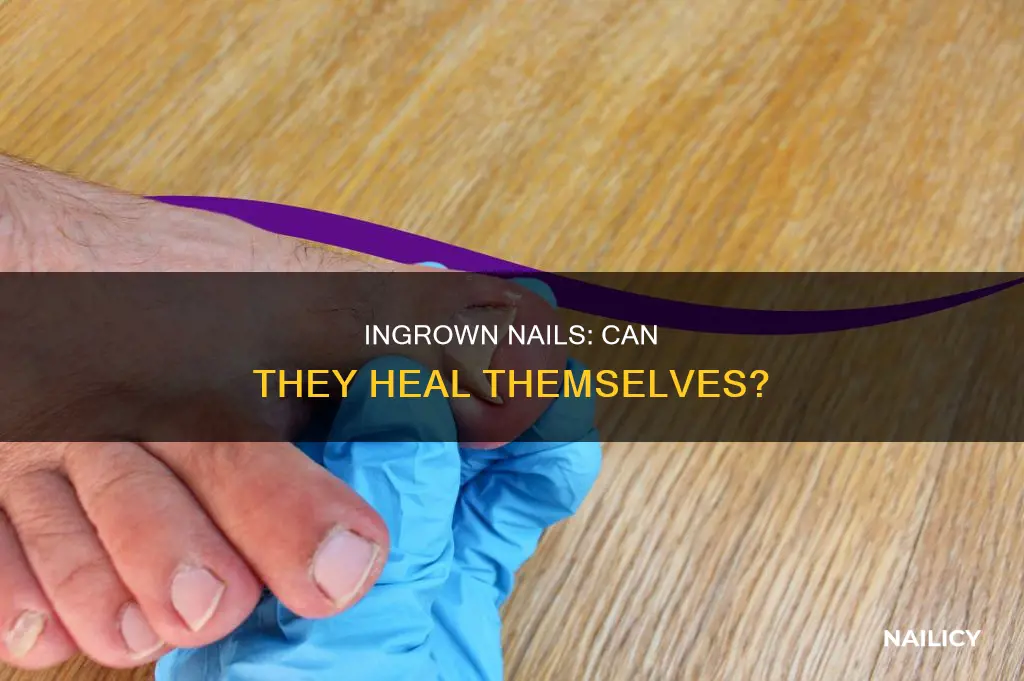 will ingrown nail from bad trimming fix itself