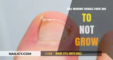 Ingrown Toenails: Can They Stop Nail Growth?