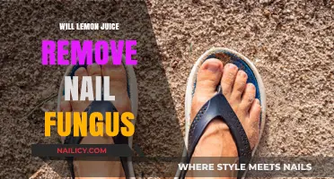 Lemon Juice: A Natural Nail Fungus Remedy?