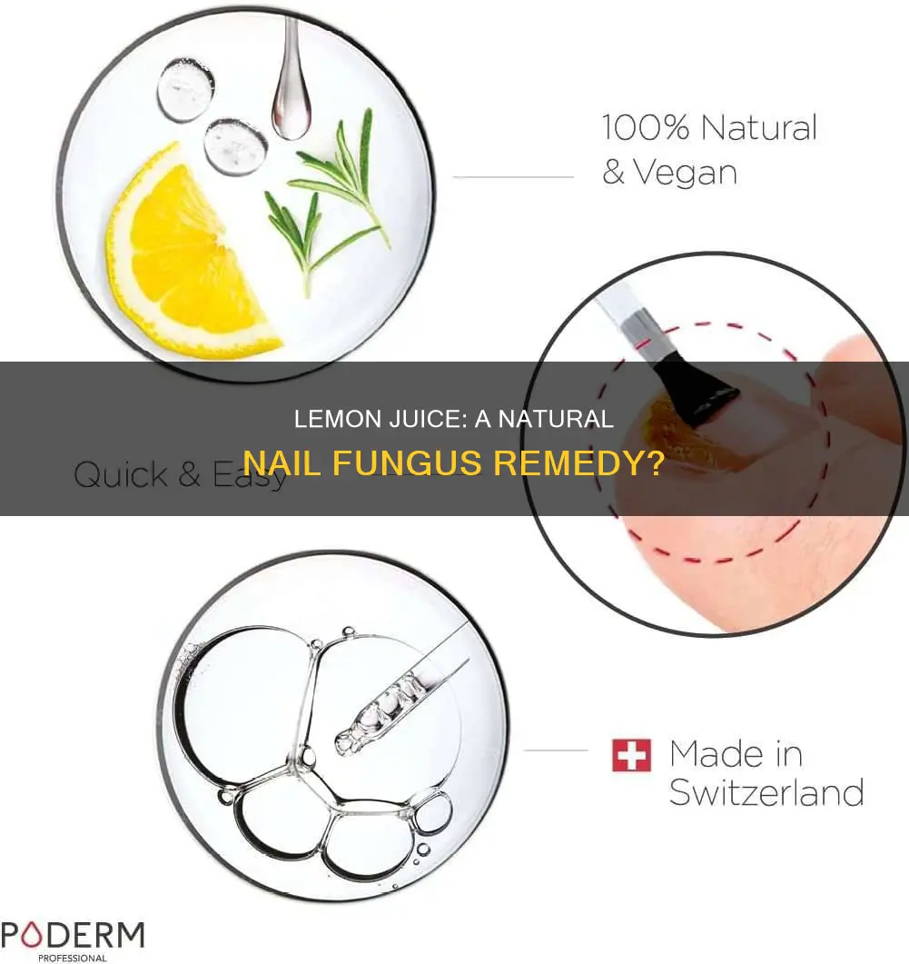 will lemon juice remove nail fungus
