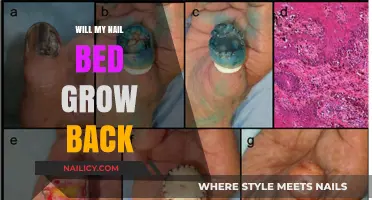 Can Nail Beds Regrow? Understanding Nail Bed Recovery