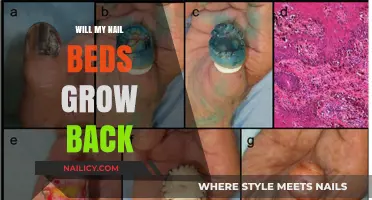 How to Restore Your Nail Beds to Their Former Glory