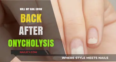 Nail Recovery: Onycholysis and Regrowth
