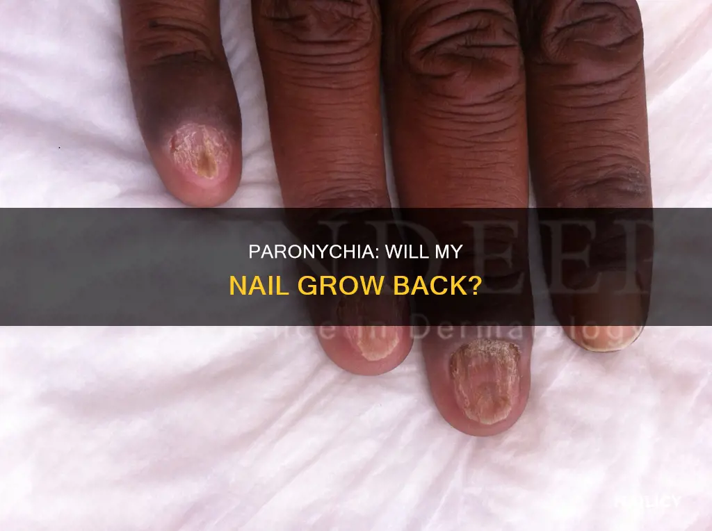will my nail grow back after paronychia