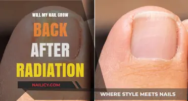 Radiation Therapy: Will Nails Grow Back?